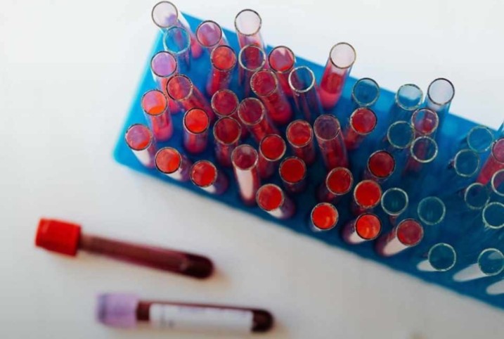 Driving Progress in the Fight Against HIV/AIDS